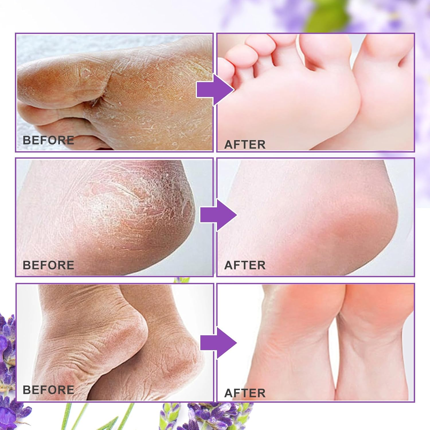 Foot Peel Mask 4 Pack, Exfoliator Peel off Calluses, Exfoliating Foot Care,Foot Exfoliator Repair Dry Cracked Feet,Peeling Away Dead Skin, Calluses, Dead Skin Callus Remover, Baby Soft Smooth Touch Feet-Men Women (Lavender)