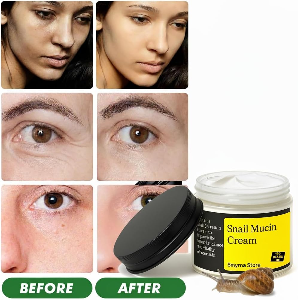 SM- Snail Mucin Face Moisturiser - Advanced Vegan Snail Cream with Barrier Repair for Sensitive Skin & Dry Skin, Lightweight Daily Facial Cream for Soft, Glowy Skin, Skin Care - 3.52 Oz -100G image number 1