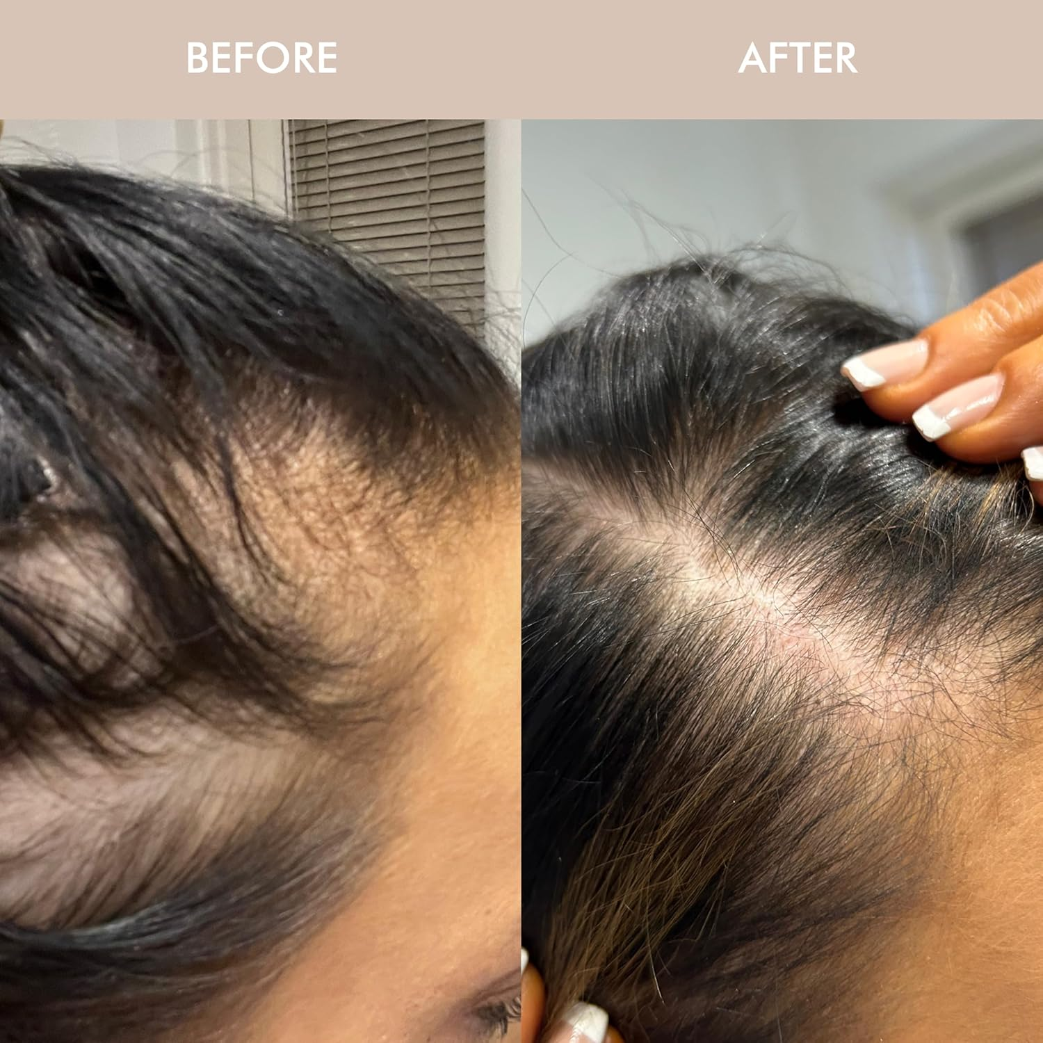 VANI-T Gloss Hair Growth Shampoo 50 Ml image number 3