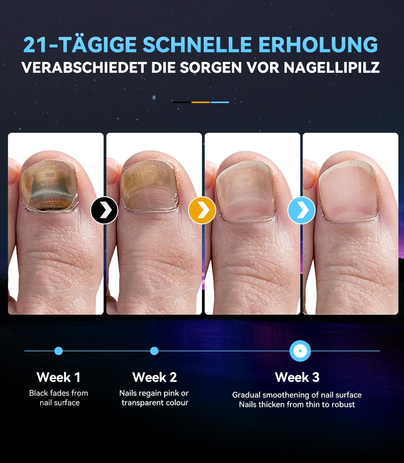 LOZLTX 5.0 Nail Fungus Laser Device, 99% Fungal Infestation Eliminated in 3 Minutes, Industry No. 1: Restoration of Healthy Nails and New Self-Confidence, Blue image number 1