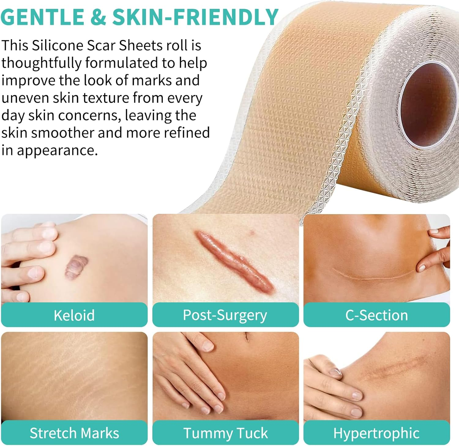 Silicone Scar Tape, Soft Silicone Scar Sheets, Reusable Medical Grade Scar Gel Patch Strips Roll for Wrinkles, Tummy Tuck, Surgical Marks, C-Section, Keloid Bump Removal, 1.6'' X 60'' image number 1