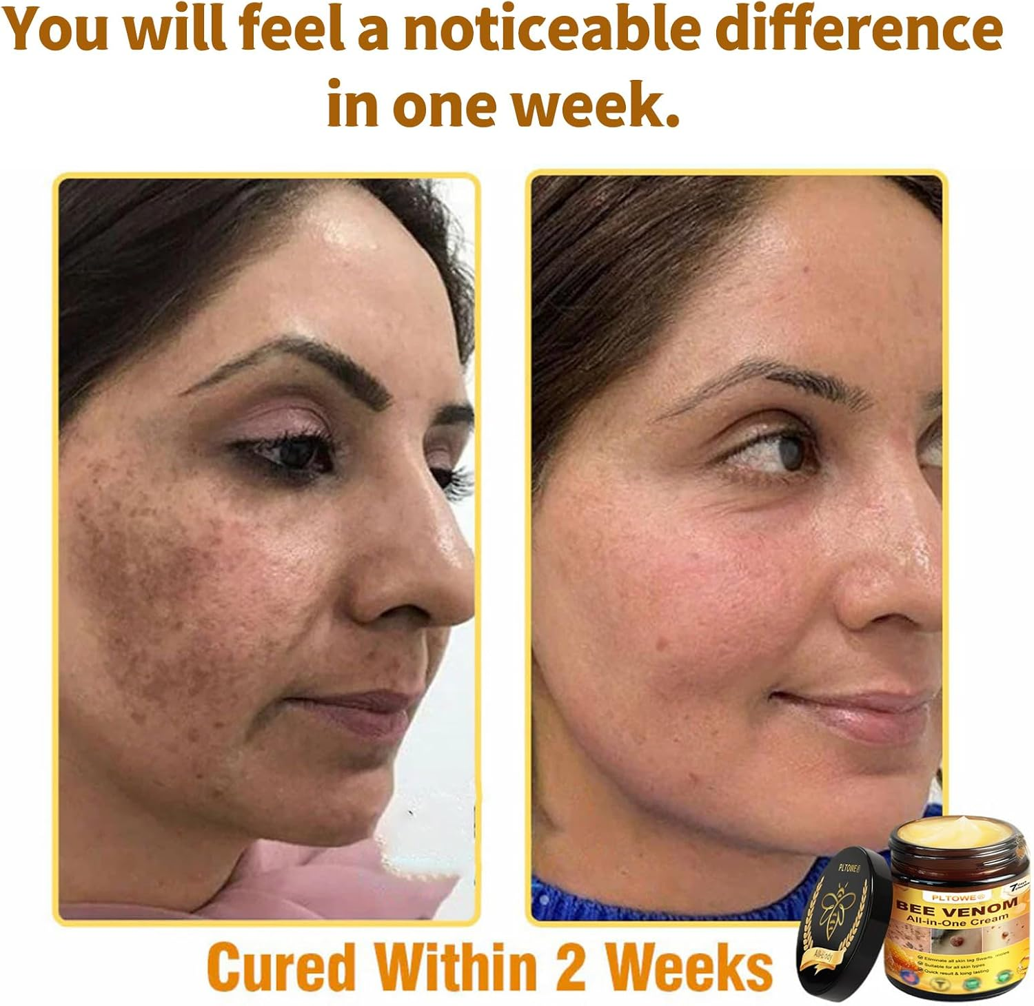 PLTOWE Bee Venom All-In-One Cream,Bee Venom Cream,Tlopa Bee Venom Skin Treatment Cream,Improve Skin Quality and Resolve Skin Problems (3) image number 1