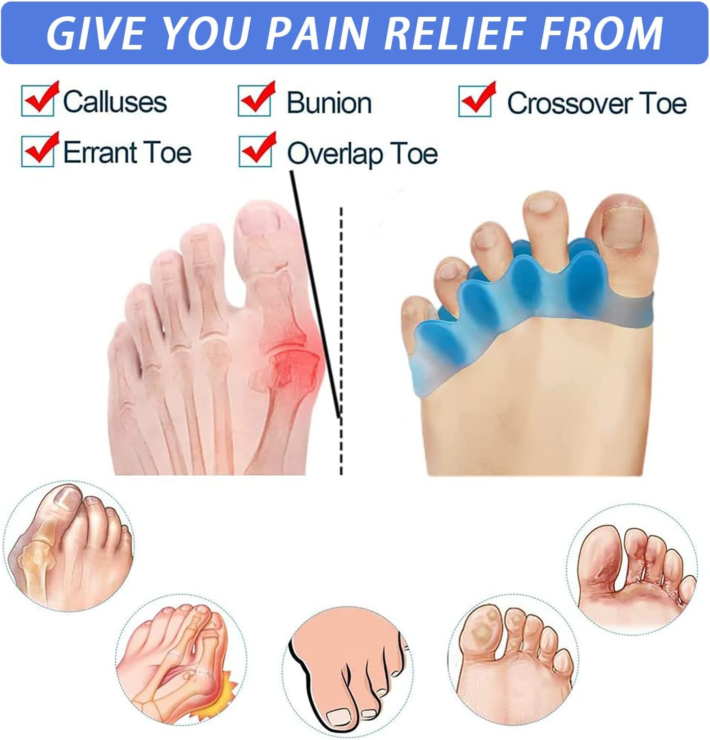 Toe Separators for Women Men, 4 Pair Silicone Toe Dividers Toe Spacers for Plantar Fasciitis Bunions Overlapping Hammer Toe Spacers