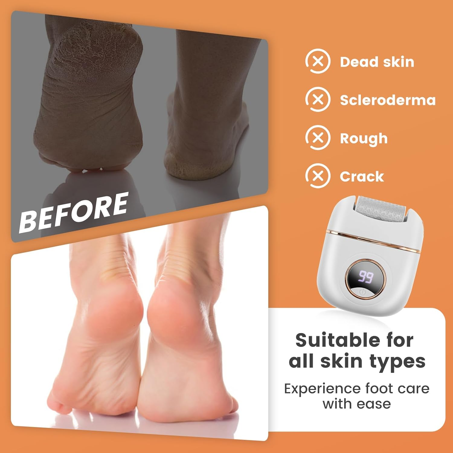 Electric Foot Callus Removers, Rechargeable Electronic Foot File Pedicure Tools, Ergonomic Foot Callus Remover for Men Women Most Skin
