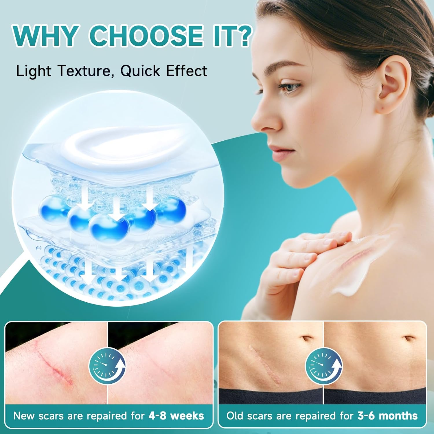 Advanced Scar Cream, Silicone Gel for Scars, Professional Scar Removal Cream for Surgical Scars, Stretch Marks, Old and New Scars 1.7 Oz(50Ml) image number 5