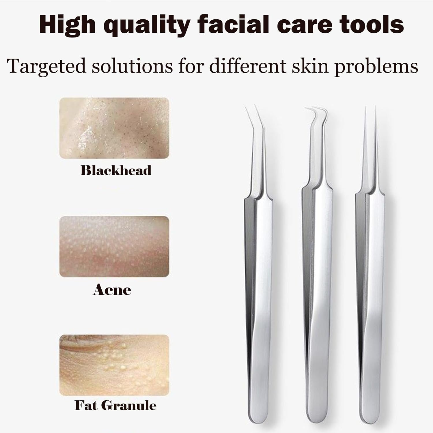 Blackhead Remover Kit with Box, Professional Stainless Steel Comedones Extractor Tool, Acne Tweezer, Pimple Popper, Blackhead Needle & Curved Tip Tool for Nose, Face, Facial Blemish Removal (16 Pcs) image number 1