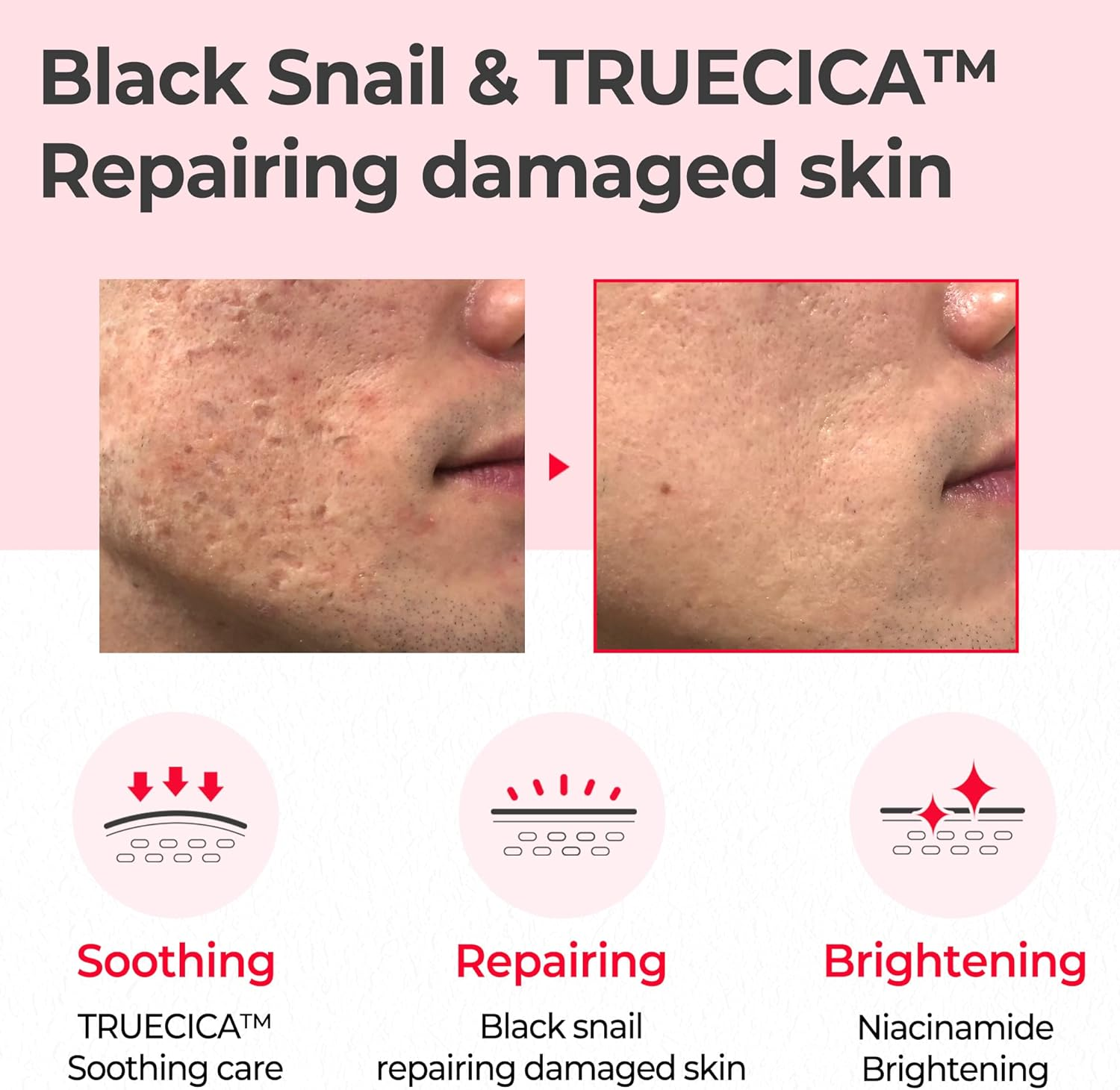 Snail Truecica Miracle Repair Toner 150Ml image number 4