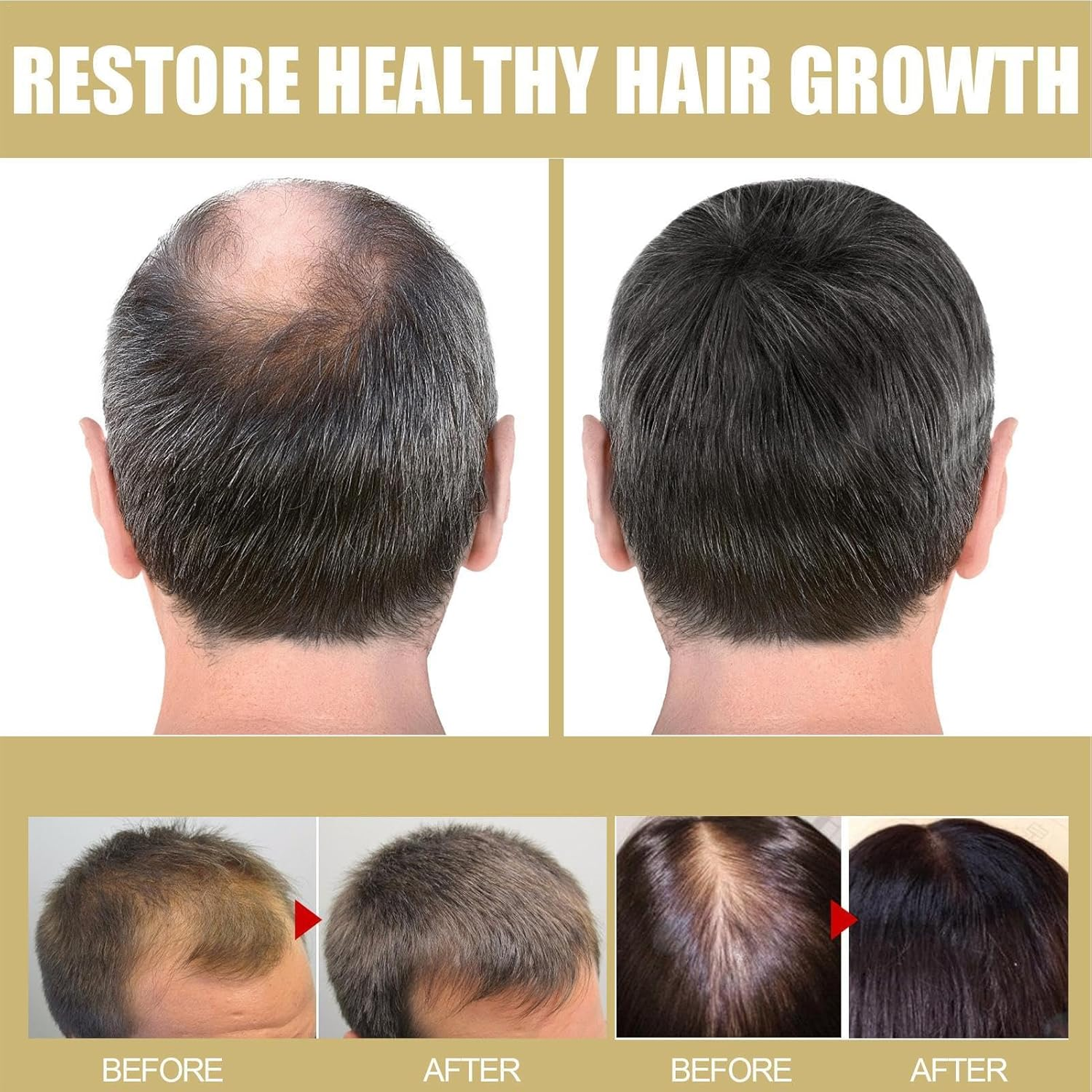 Hair Steamer Deep Conditioning - Heat Shower Cap | Hair Care Heating Hat | 2 Temperature Mode Electric Hats Hair Massage Steamer | Hair Colouring Caps for Natural Hair Portable Heat Hair Spa image number 3