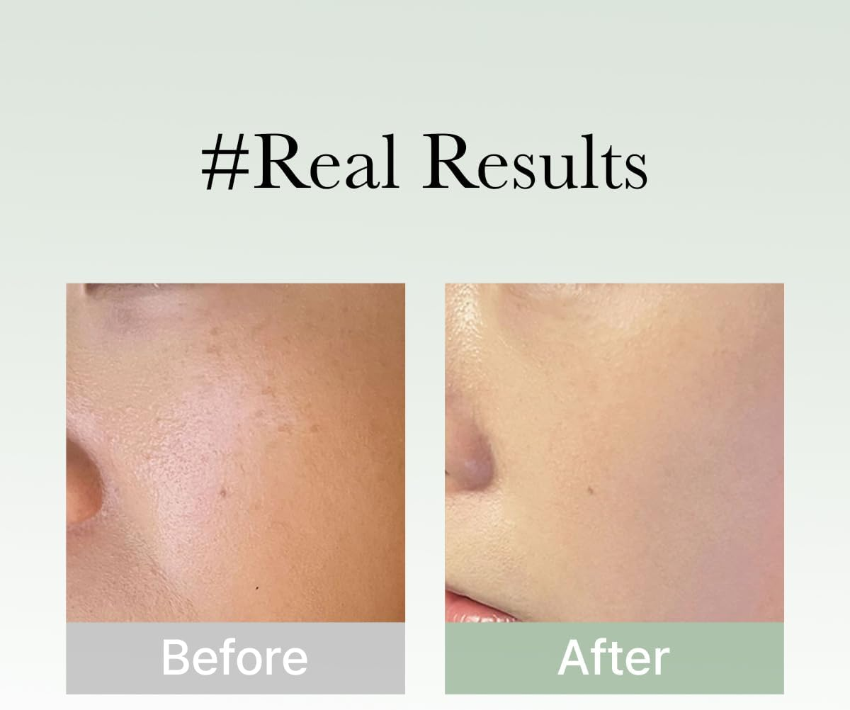 Medicube Arencia Holy Hyssop Serum 30 Ml image number 6