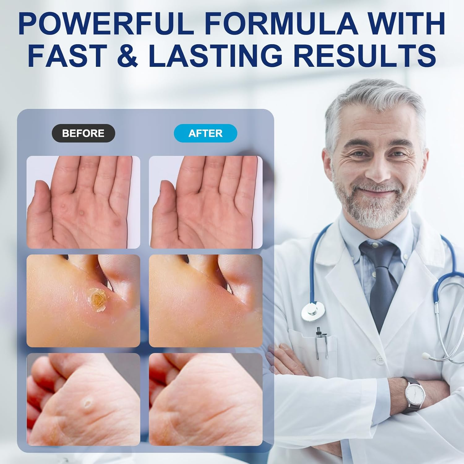 Liquid Corn Remover, Corn Removers for Toes, Extra Strength Liquid for Corn, Safe Removes Corns and Callus, 15Ml Liquid with 15PCS Cushions 10PCS Swabs (15ML*1) image number 3