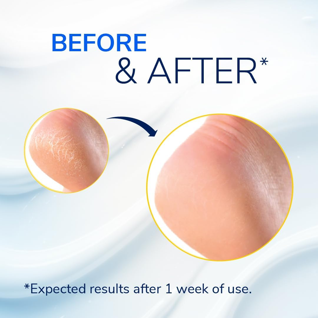 Dr. Scholl'S Severe Cracked Heel Repair Restoring Balm 2.5Oz, with 25% Urea for Dry, Cracked Feet, Heals and Moisturizes for Healthy Feet, Epsom Salt Soothes, Safe for Diabetics, 3-Pack