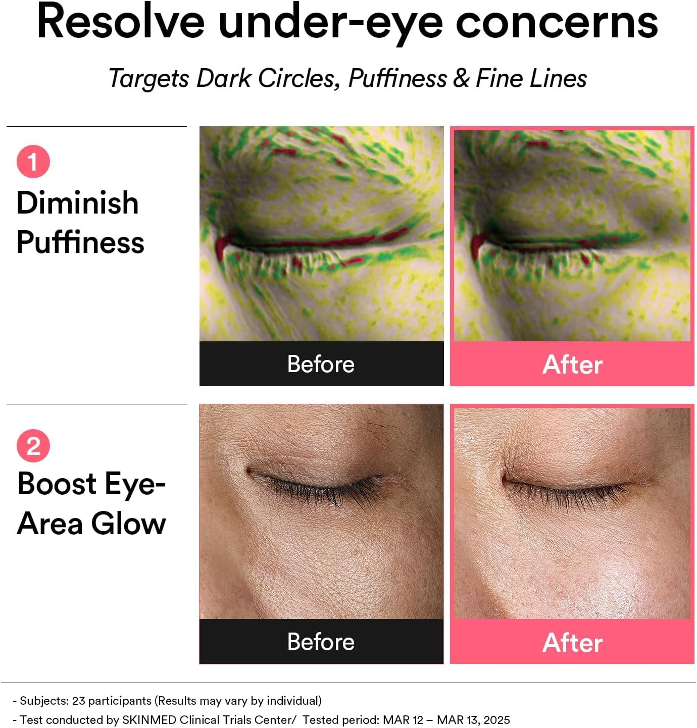 Abib PDRN Retinal Eye Patch, Hydrogel Masks for Dark Circles, Puffiness, Fine Lines, 60 Patches, 84G, with Niacinamide, K-Beauty Skincare image number 3