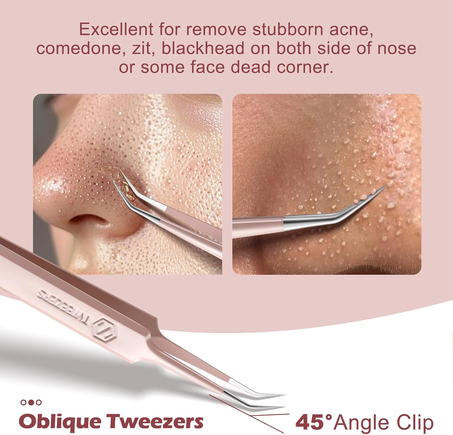 WSYUB Professional Facial Blackhead Remover Tweezers,Extractor Acne Removal, Pimple Popper Tool Kit, Clip for Whiteheads, Acne Clip, Ingrown Hairs Tweezers, Blackheads Tweezers image number 1