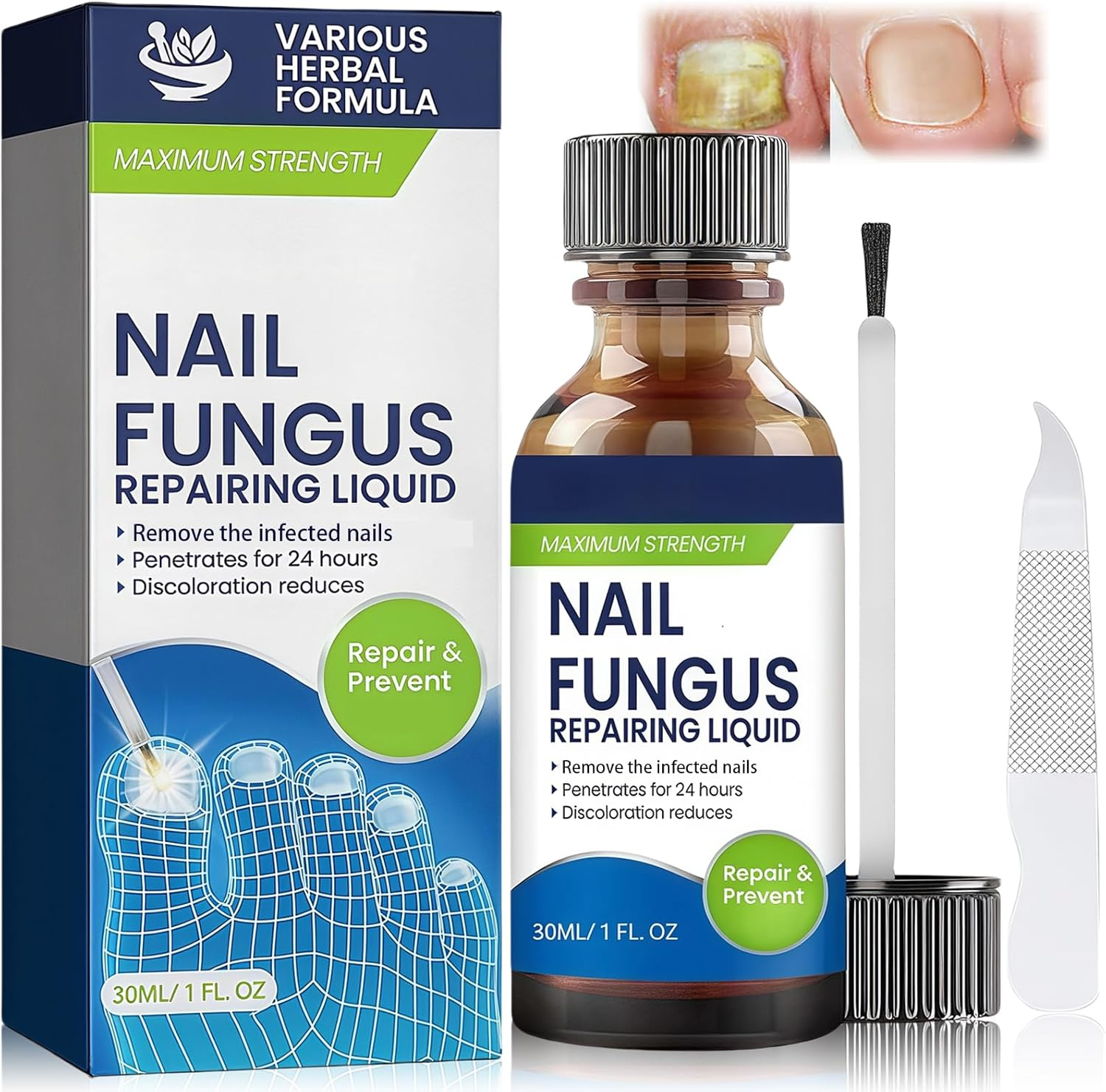 Fungal Nail Treatment - Fast-Acting Solution for Thick, Discolored Toenails &ndash; Revitalize Yellow & Brown Nails with Our Powerful Formula &ndash; Quick, Effective Relief for Beautiful Nails image number 3