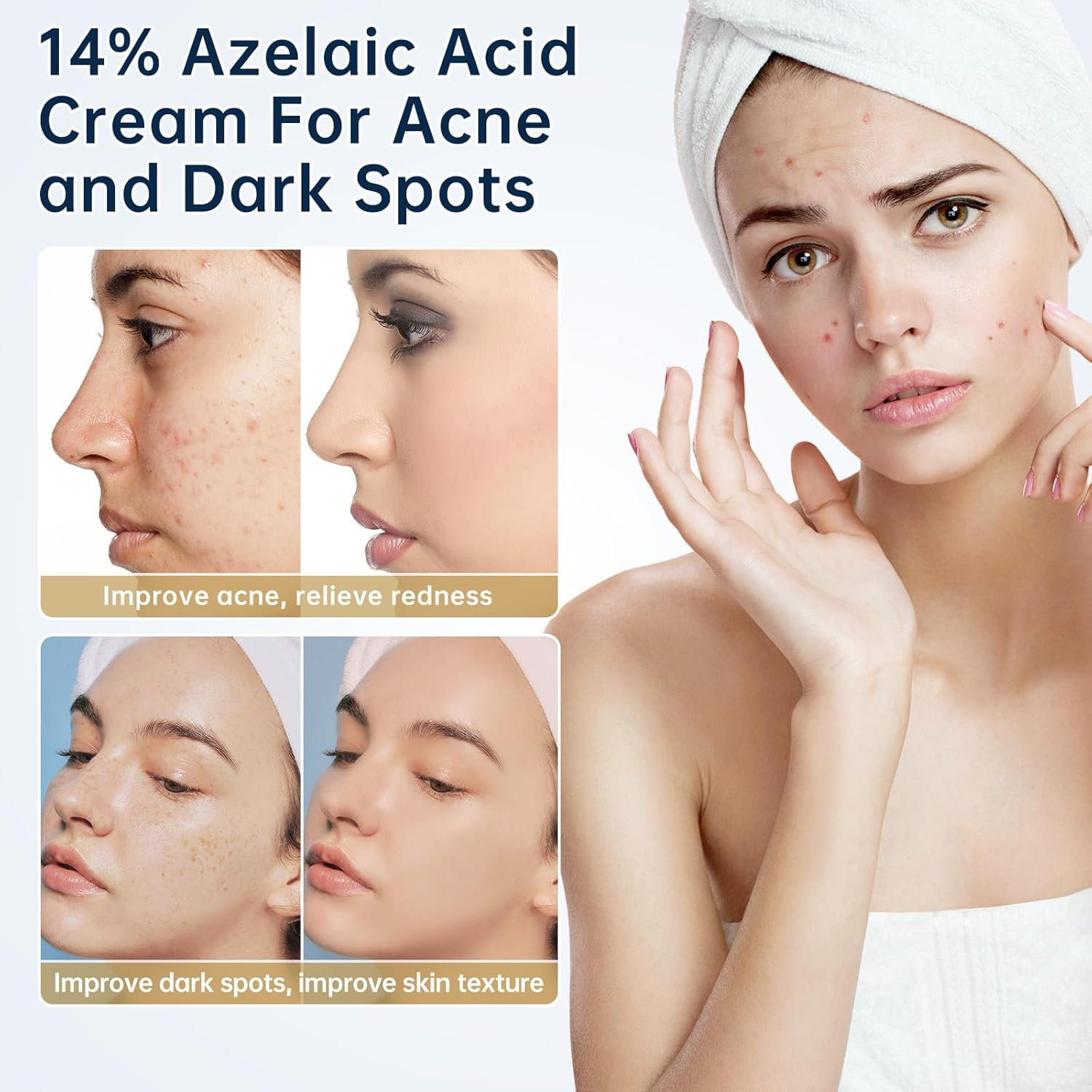 Azelaic Acid 14 Percent Cream for Face, Azelaic Acid Gel, 30ML Azelaic Acid Acne Cream with Salicylic Acid, Niacinamide & Vitamin C for Dark Spot. image number 3