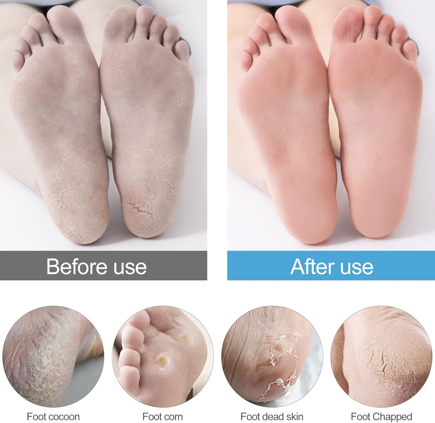 Sularpek Callus Rasp, Foot File Pedicure, Callus Rasp for Callus Removal, Foot File Made of Stainless Steel, Black image number 2