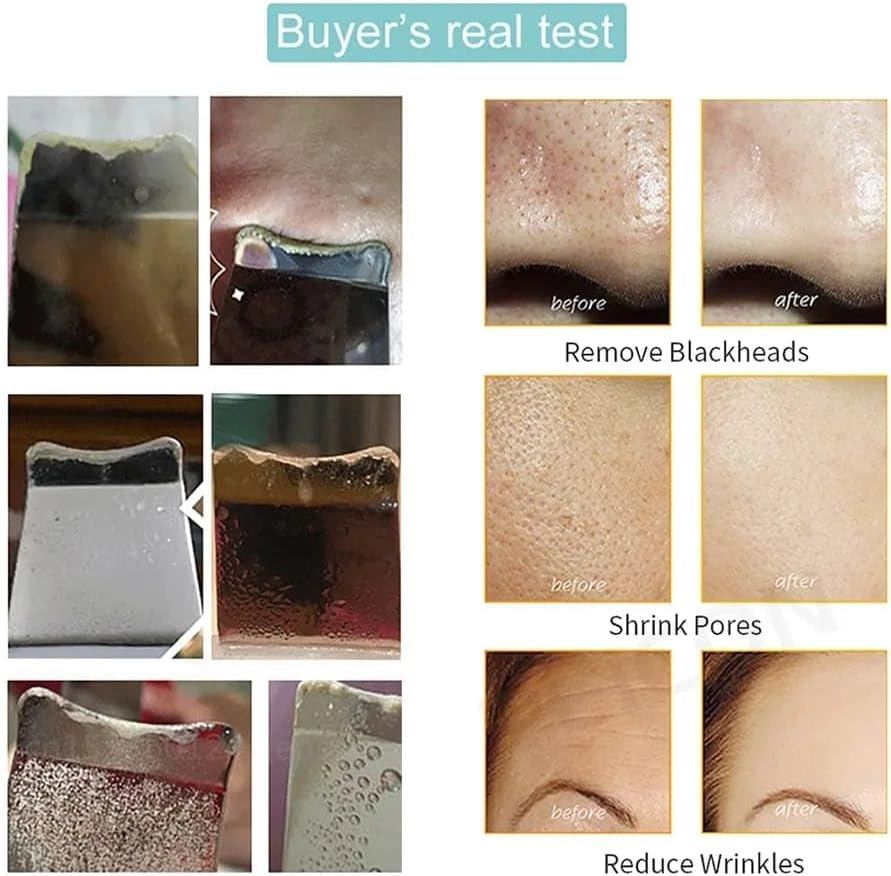 Ultrasonic Skin Scrubber Peeling Blackhead Remover Deep Face Cleaning Ultrasonic Ion Ance Pore Cleaner Facial Shovel Cleanser image number 6