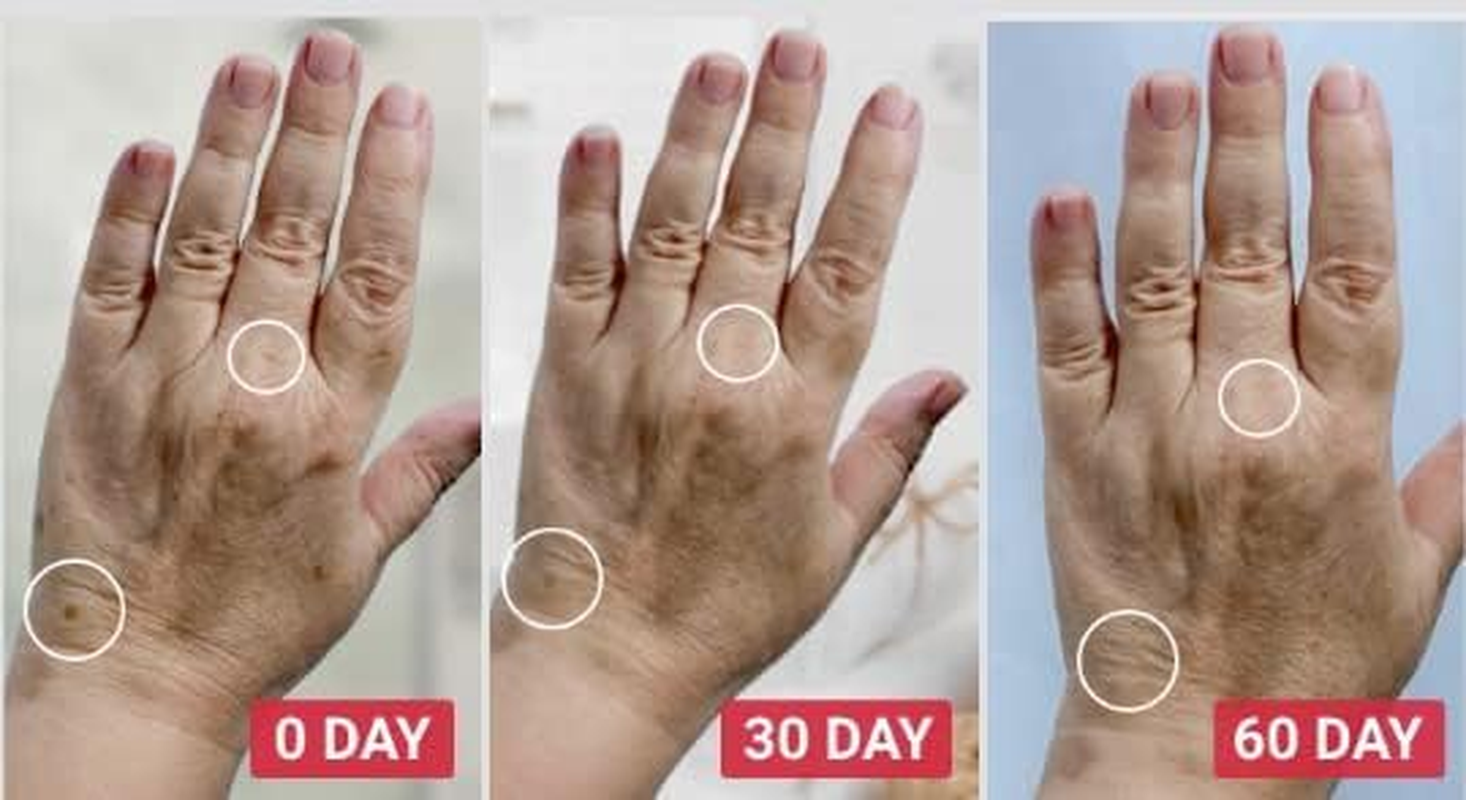 Lifecell Overnight Hand Treatment