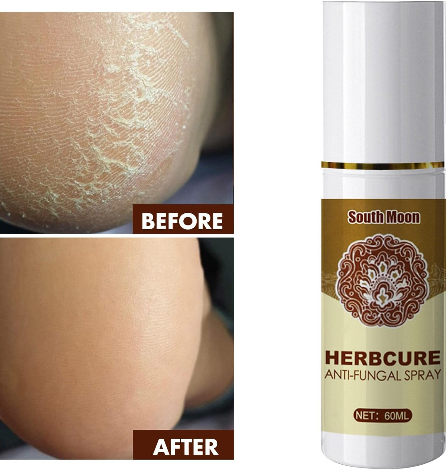 Foot Spray Anti-Fungal Infection Beriberi Spray Damaged Skin Moisturizer image number 3
