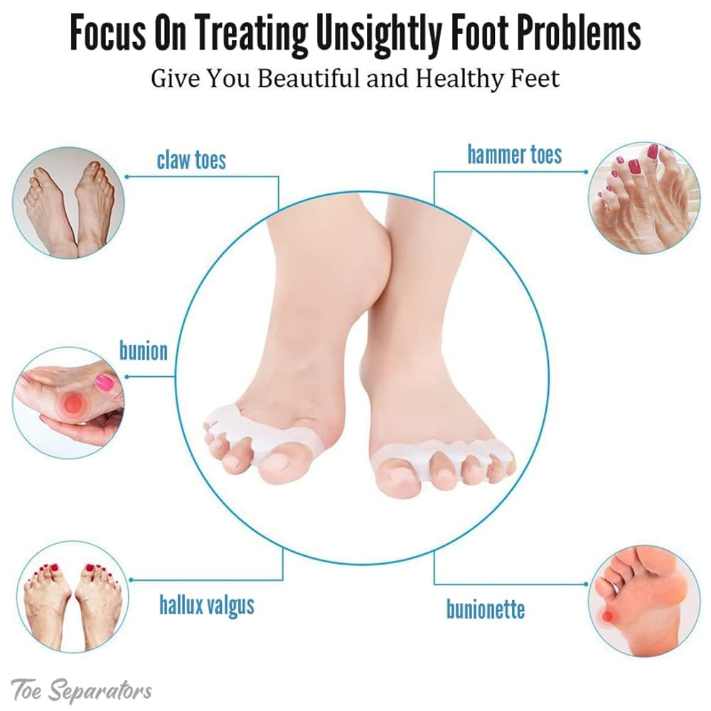 Silicone Toe Separators for Bunion Correction &ndash; Toe Spacers & Spreaders for Pain Relief &ndash; Unisex Comfort for Hammer Toes, Overlapping Toes (2Pair) image number 1