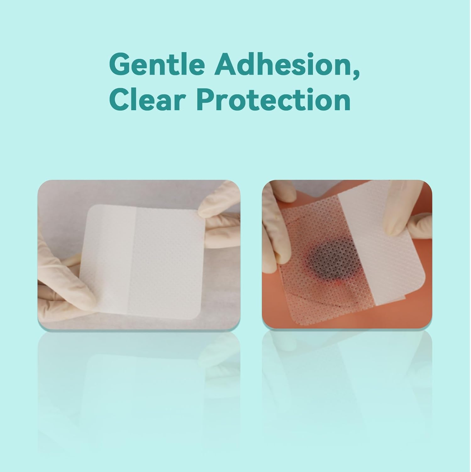 Dimora Silicone Wound Contact Layer, Adaptic Non-Adhering Dressing, Transparent Wound Dressing Pads, 3In X 4In (7.5Cm X 10Cm), 10 Pcs image number 6