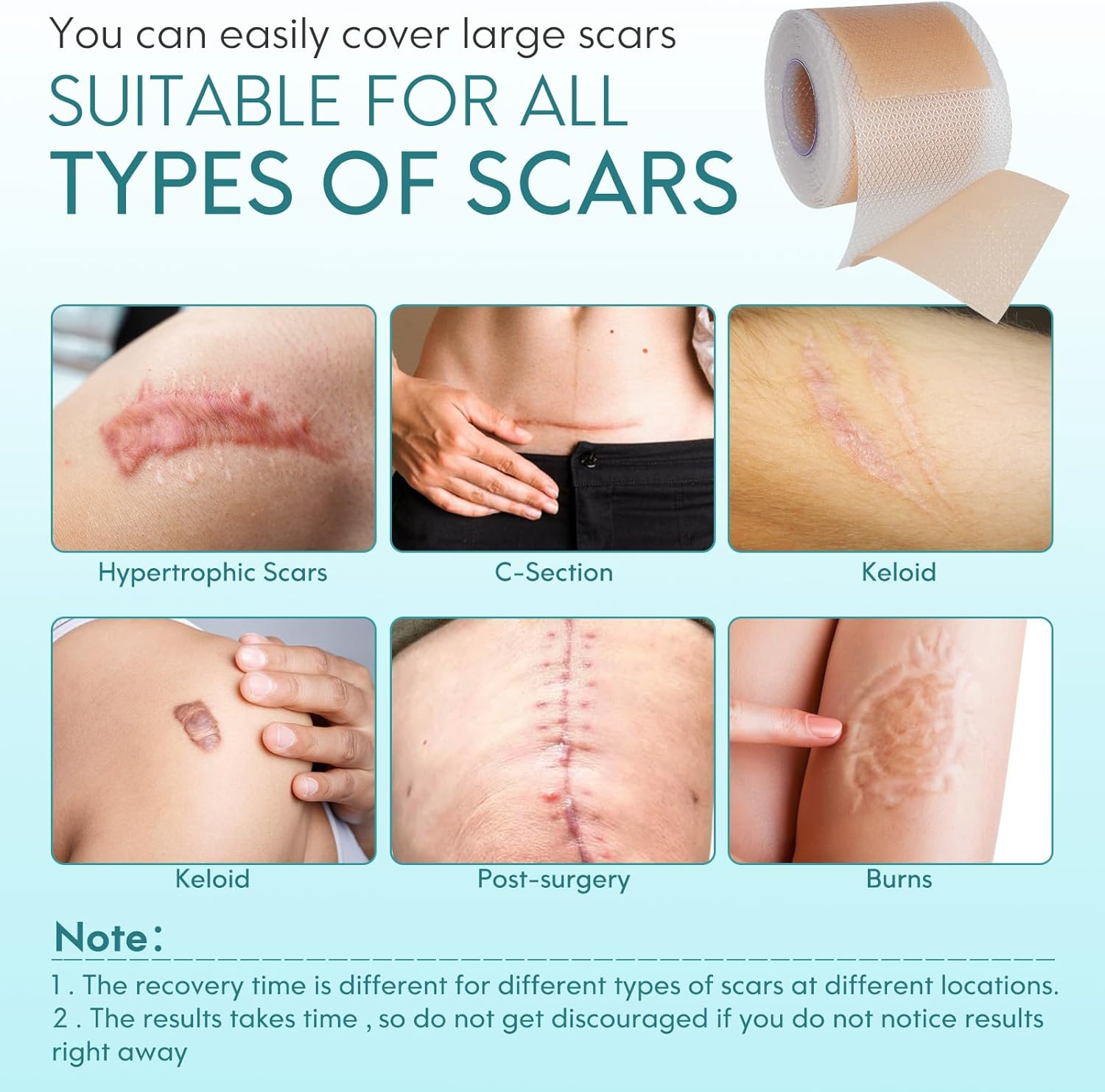 Silicone Scar Tape(1.8" X 157" Roll - 4M), Silicone Scar Sheets, Silicone Scar Tape Roll, Scar Silicone Strips, for C-Section, Surgery, Burn, Keloid, Acne Etc image number 5