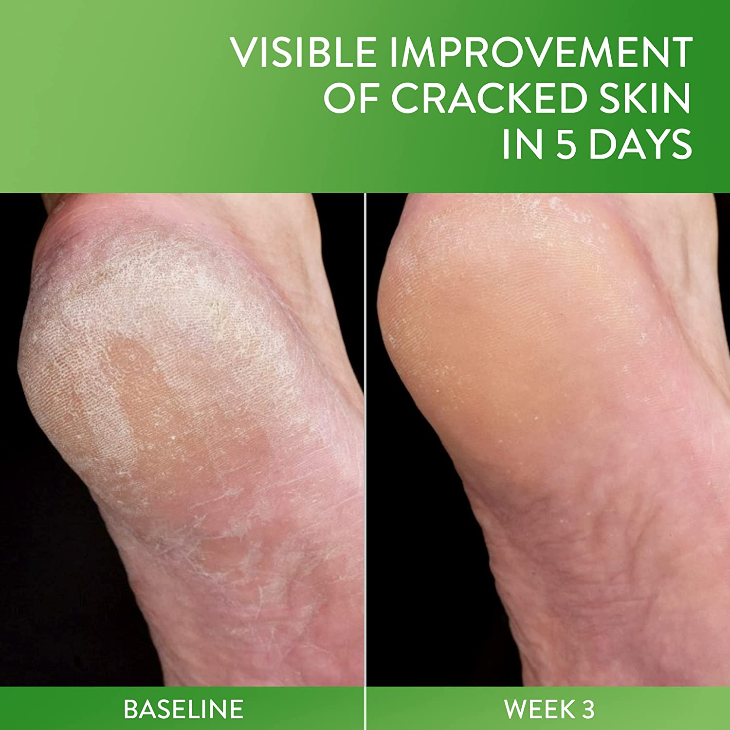 CETAPHIL Cracked Skin Repair Balm | 3 Oz | for Very Rough & Cracked, Sensitive Skin | Protects, Soothes and Restores Deeper Cracks | Hypoallergenic | Fragrance Free | Dermatologist Recommended image number 1