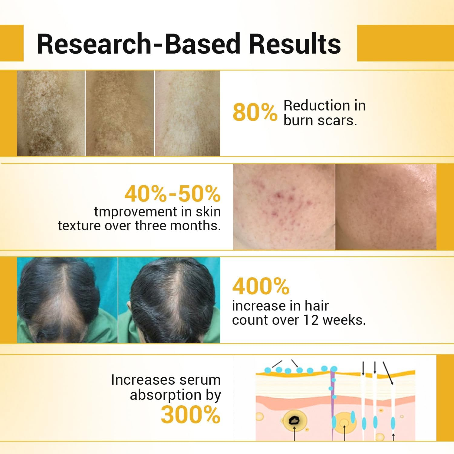 Sotrue Professional Derma Roller for Hair Growth 1 Mm with 192 Stainless Steel Needles Repairs Damaged Hair,Hair Thickening Reduces Acne Scars Safe Effective to Use image number 2