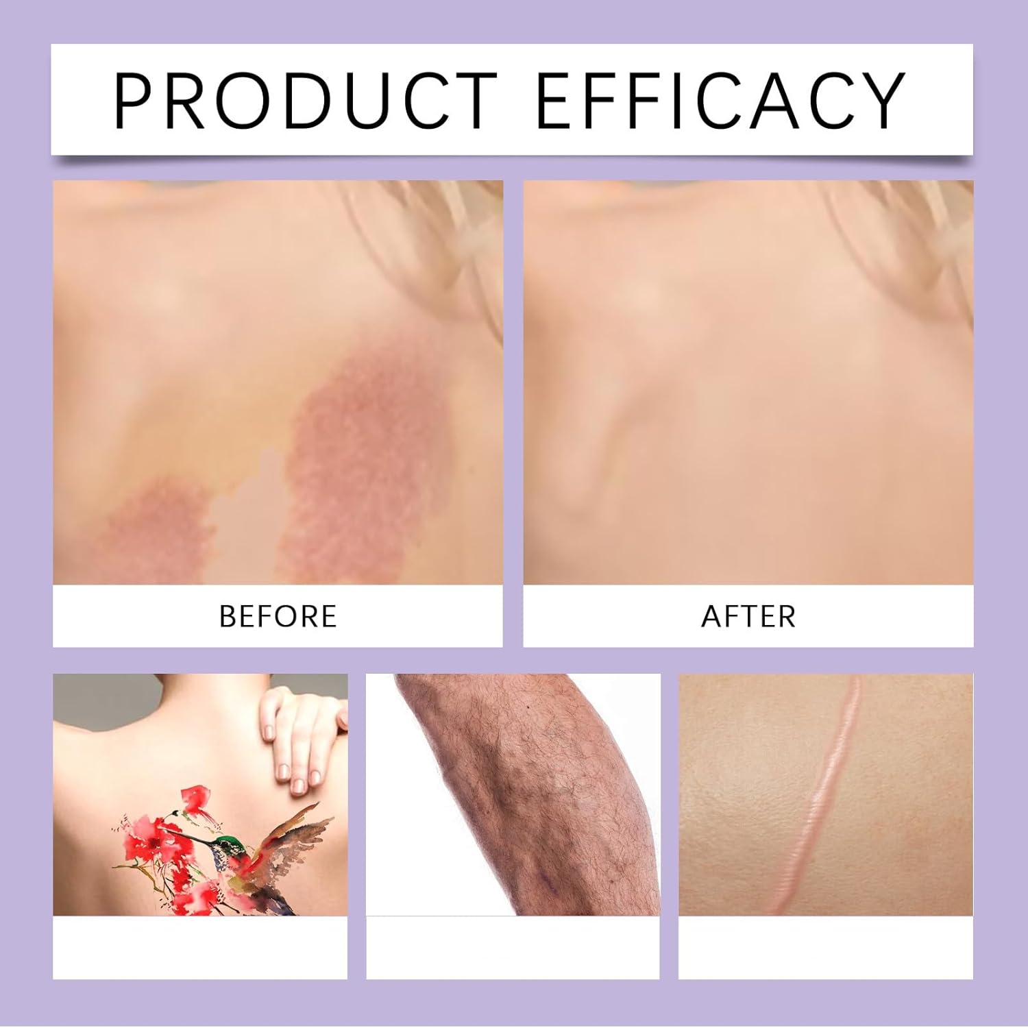 Body Coverage Perfector with Brush &ndash; 2-In-1 Body Camouflage and Illuminator, Long-Lasting Sweat-Proof Concealer, Waterproof Full Coverage for Legs & Body (Warm Radiance) image number 6