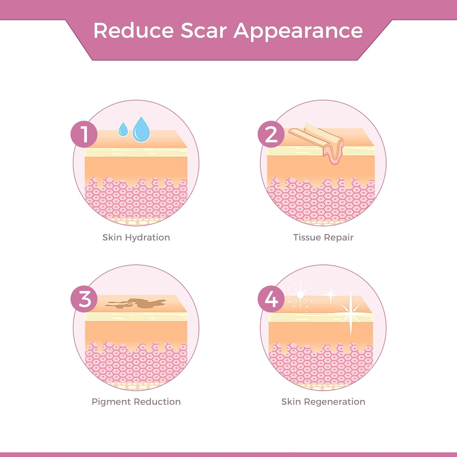 Professional Medical Silicone Scar Tape - Grade Scar Sheets, Non Irritating, Painless for C-Section, Surgical Scars, Burn, Keloid, Acne, Provide Safe and Effective Solutions(1.6&rdquo; X 60&rdquo; Roll)