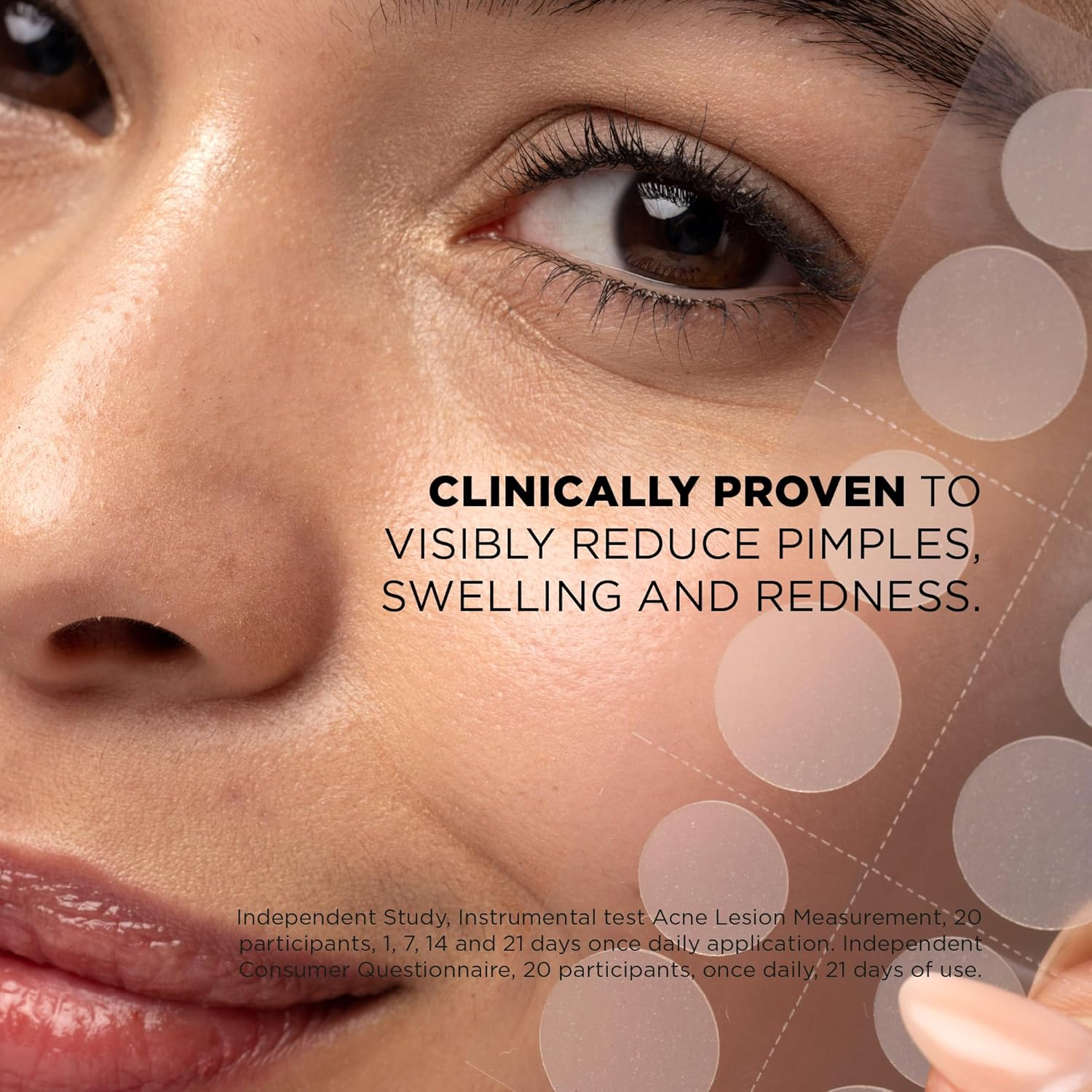 Skin Republic Spot Clear Patch + Salicylic Acid. Clinically Proven to Reduce Pimples Day and Night. Made in Korea. 3 Pack (144 Pimple Patches).