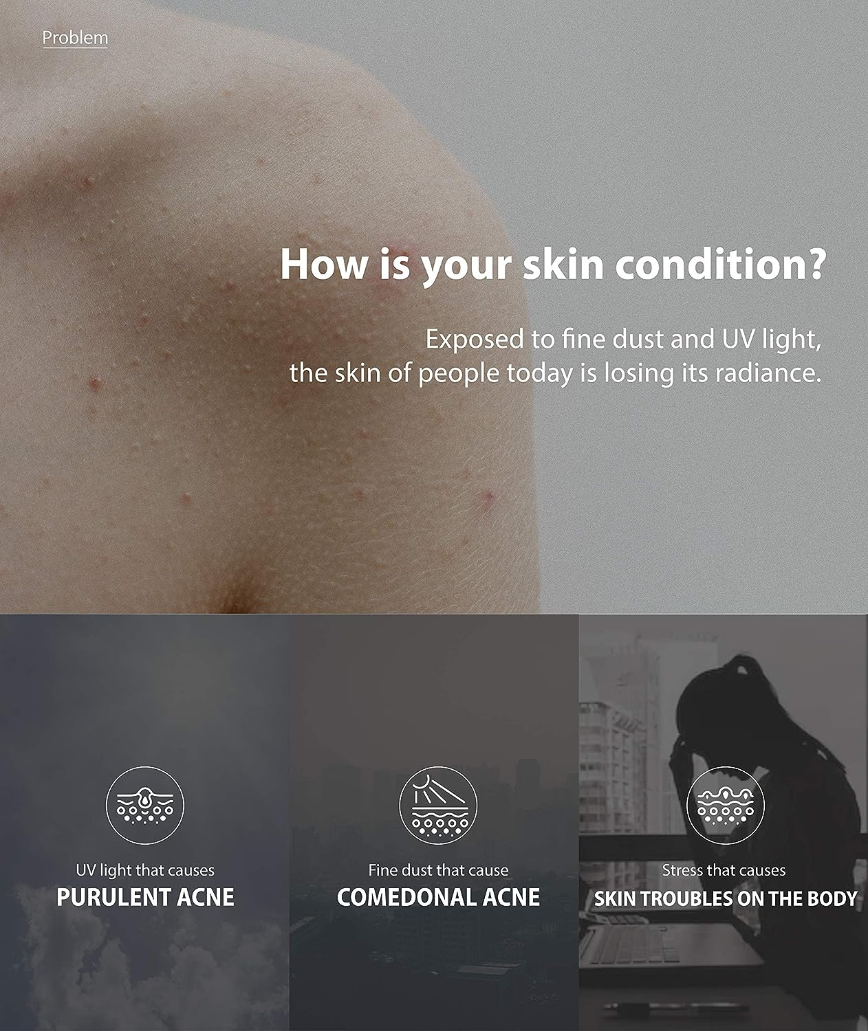 Anua Heartleaf 77% Soothing Toner I Ph 5.5 Skin Trouble Care, Calming Skin, Refreshing, Purifying (40Ml / 1.35 Fl.Oz.) &hellip;