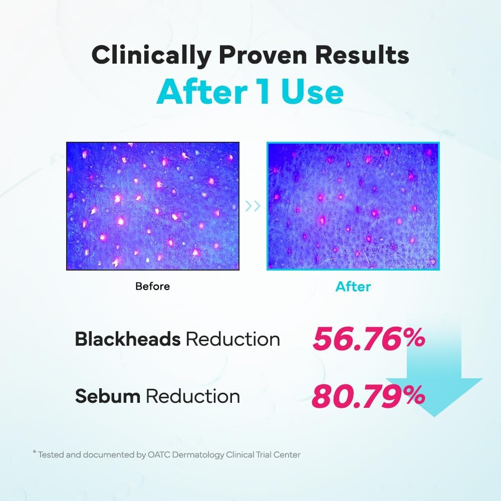 SAM'U Galacto Pore Water Full Cleansing Oil for Face, Korean Facial Cleanser & Makeup Remover with Galactomyces & Rice Bran Oil, Non-Comedogenic, All Skin Types, 200Ml image number 5