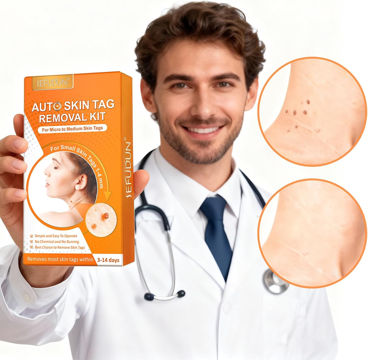 Warts Removal Pen Small Tip Single Set, Skin Tag Remover,Skin Tag Remover Pen,Wart Removal Kit, Safe and Painless, Suitable for Most Body Parts, Including Repair Patches and Cleaning Wipes image number 2