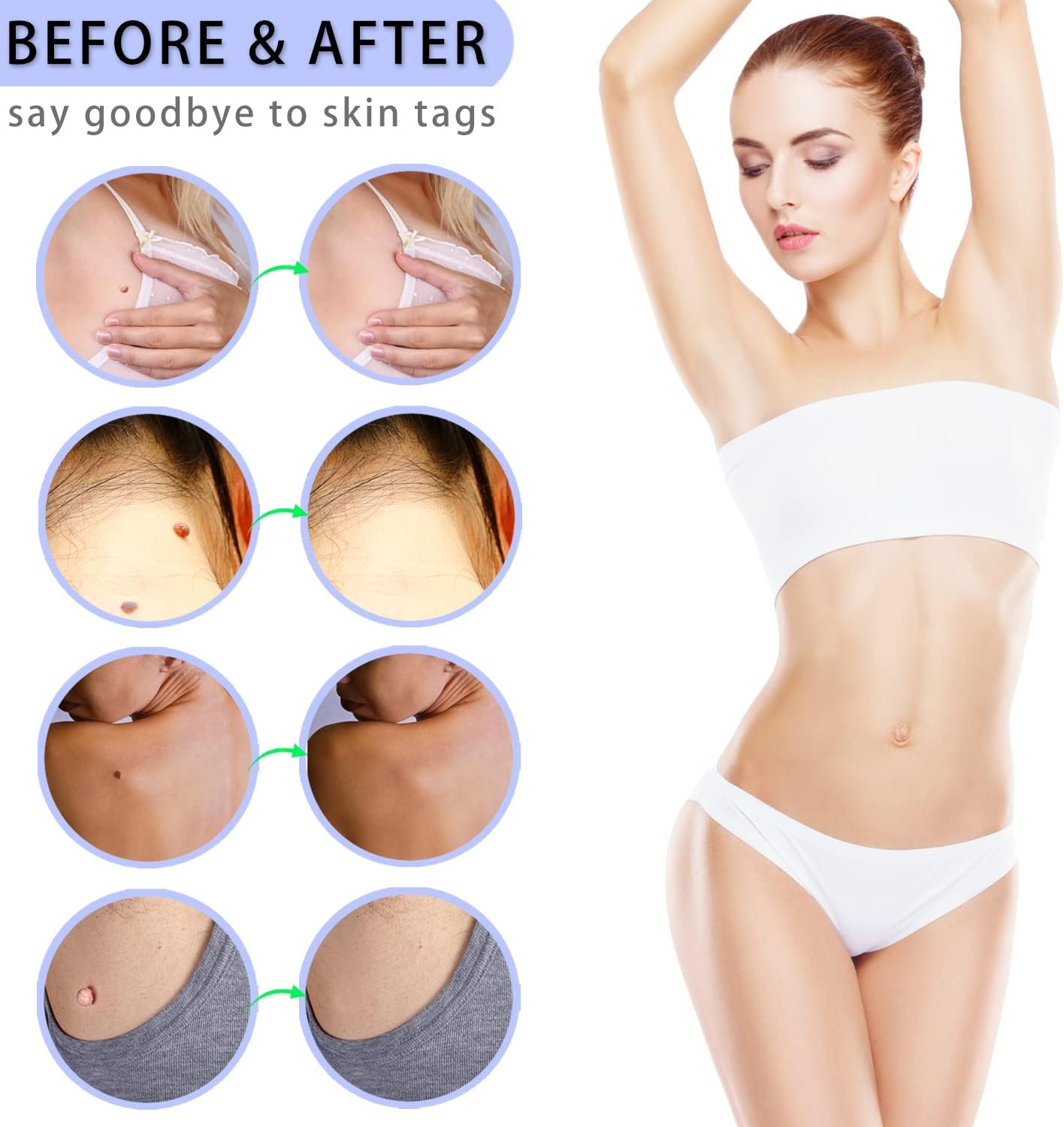 Auto Skin Tag Removal Pen - Remover 2 in 1 Standard and Micro 36Pcs Repair Patches Safe for Small to Large (2Mm to 8Mm) Sized Skin Tags for Most Body (Auto Blue) - Auto Blue image number 5