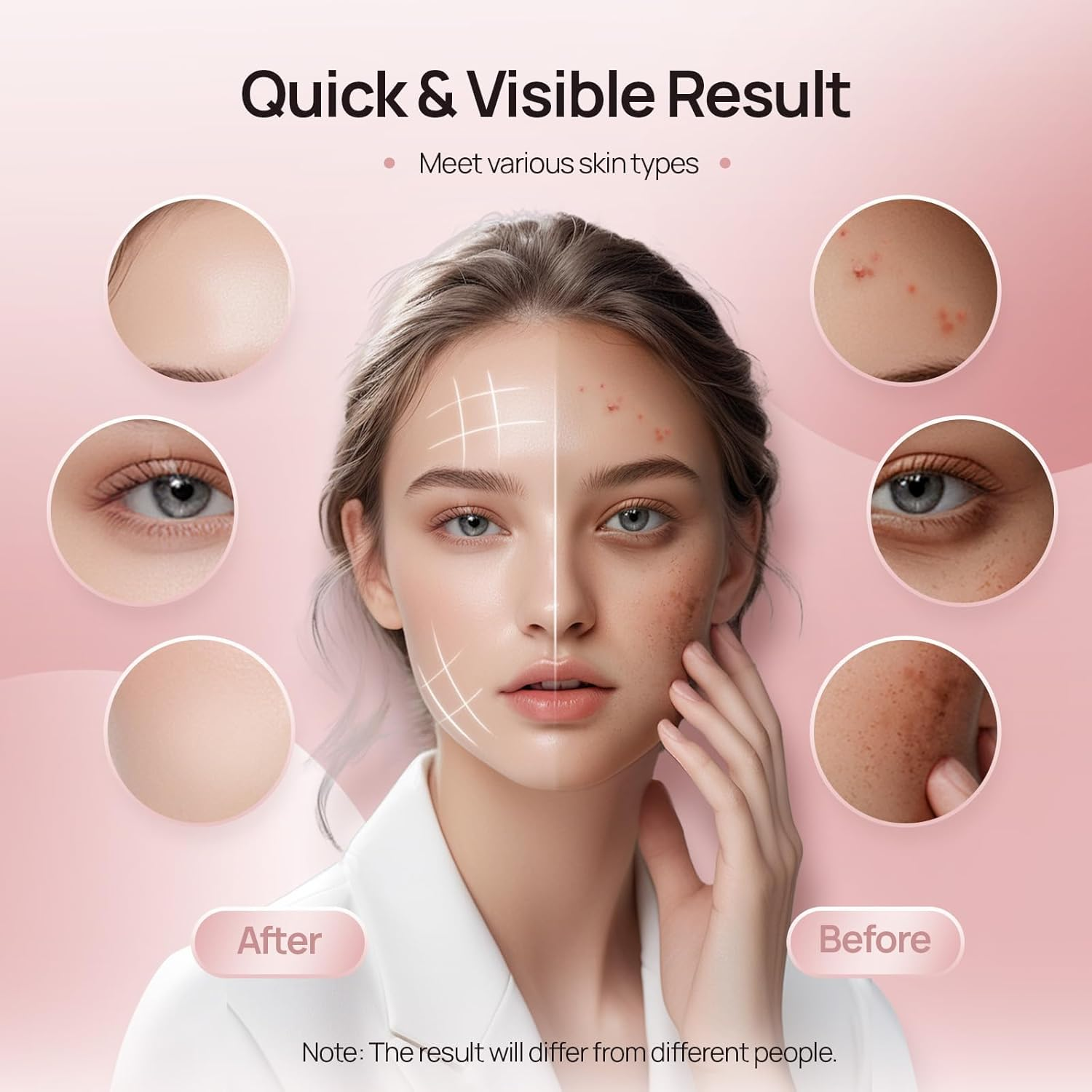 LED Therapy Mask for Face, 4 Wavelength Color LED Face Mask, Portable Infrared Red Light Facial Mask with Remote and Timing for Skin Care at Home Travel, Gift Box Package, Black image number 1