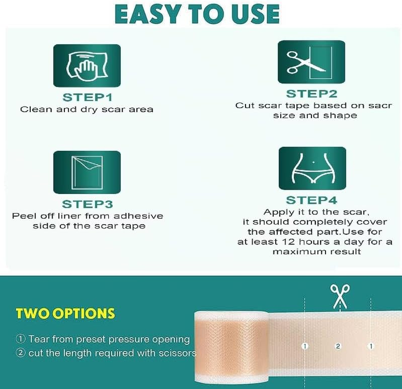 Silicone Scar Tape, Advanced Professional Removal Patch Strips, Reusable Sheets, for Keloid Scars, C Section, Burn, Scratch, Birthmarks, Tummy Tuck, Acne Etc., Works with Old and New Scar (4X150Cm Roll) image number 2