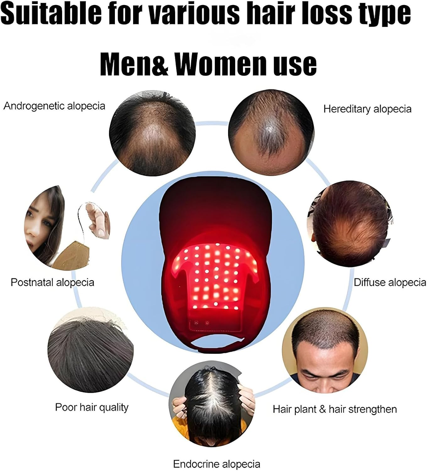 Anberyoo LLLT Cap for Hair, Red Light Therapy Hair Cap, 630Nm 650Nm Red and 470Nm Blue Light Irradiation, Rechargeable Portable Cordless Prevent Hair Loss Cap for Women Men Hair Care/Maintenance image number 1