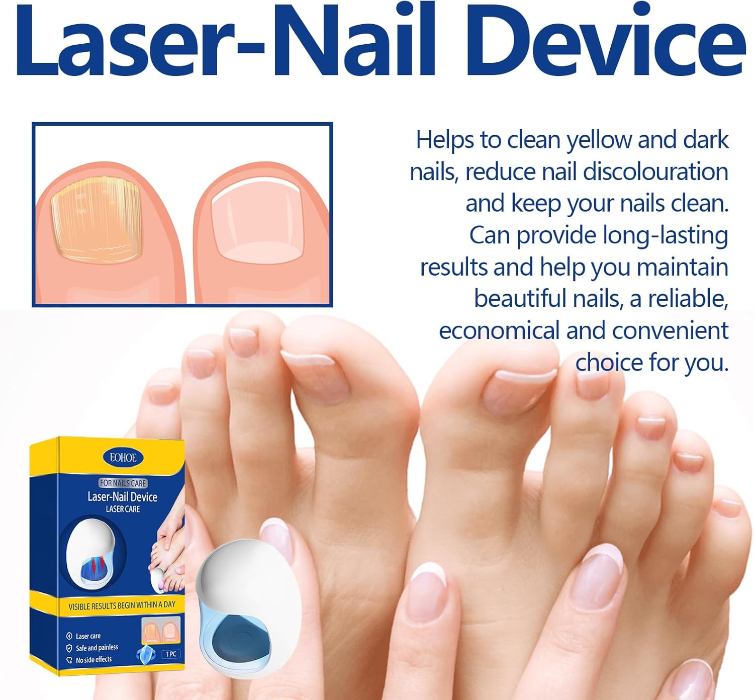 Mingzhe Laser-Nail Device Nail Fungus Cleaning Laser Device Nail Fungus Laser Treatment for Damaged Discolored Thick Toenails & Fingernails image number 2