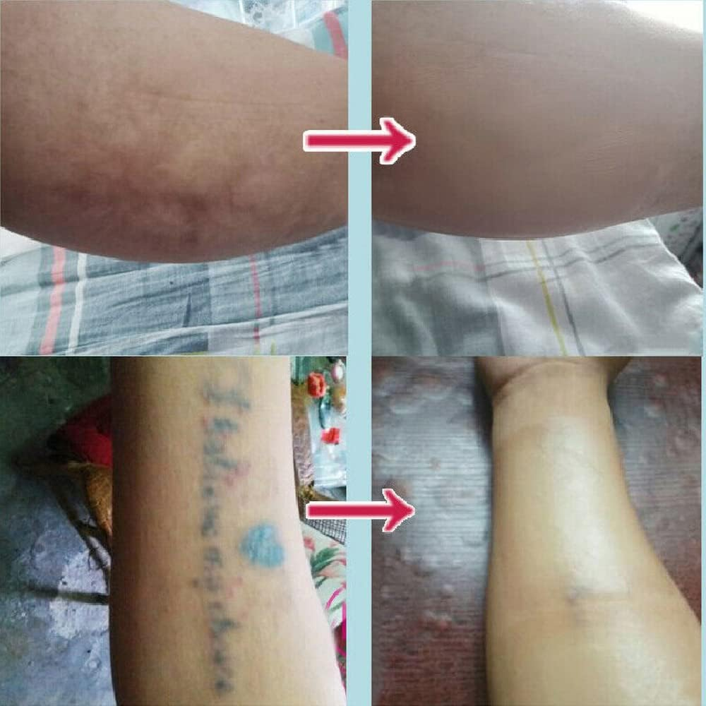 5X Tattoo Scar Acne Cover Cover up Sticker Birthmark Waterproof Hide Tape Normal Skin Tone - 5X Light Skin Tone image number 7