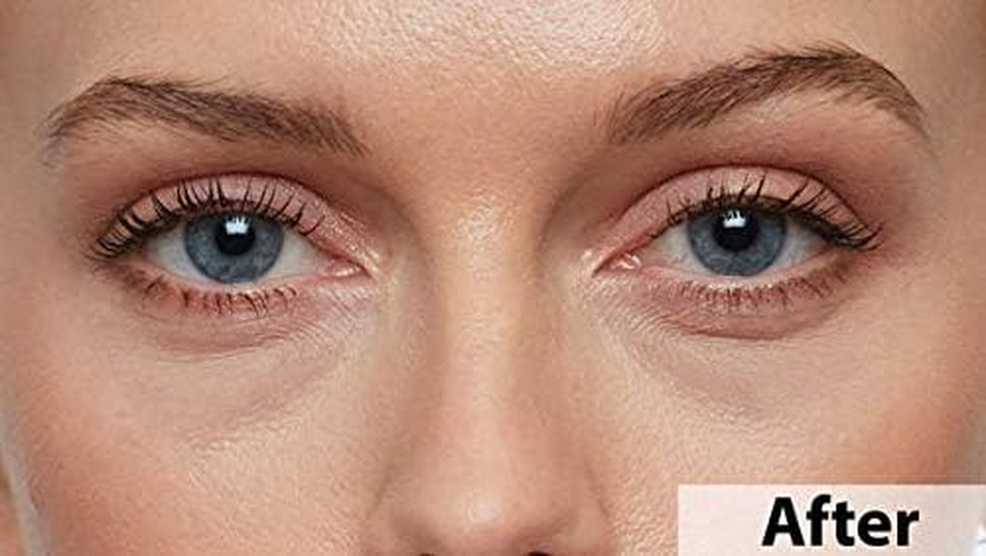 Thin Lizzy Age-Reverse Undereye Treatment Concealer with 2% HALOXYL&trade; (Miss Don Vita) - Angel image number 4