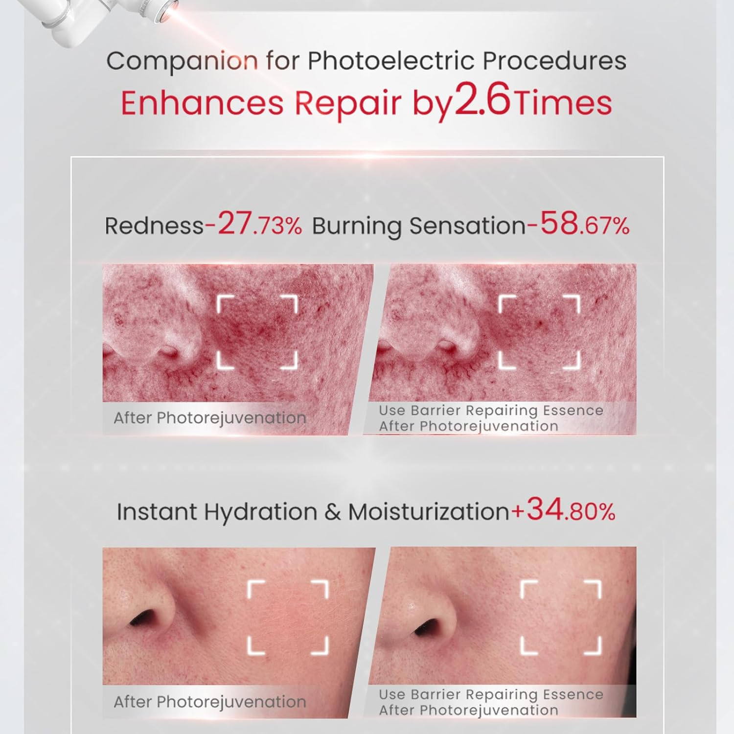 Winona Face Serum 1.5Ml&times;30, Barrier Repairing Essence for Sensitive & Fragile Skin, Single-Dose BFS Ampoule Design, Portable, Hydrating Repair Essence, Boosts Collagen & Strengthens Skin Barrier image number 6