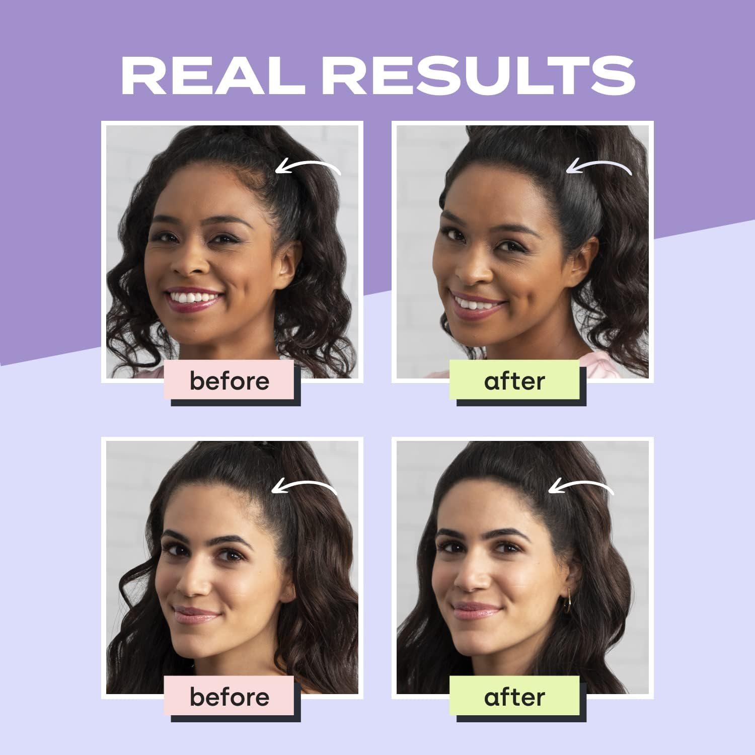 Toppik Hair Filler Keratin Hair Fiber - Blends in Perfectly image number 5