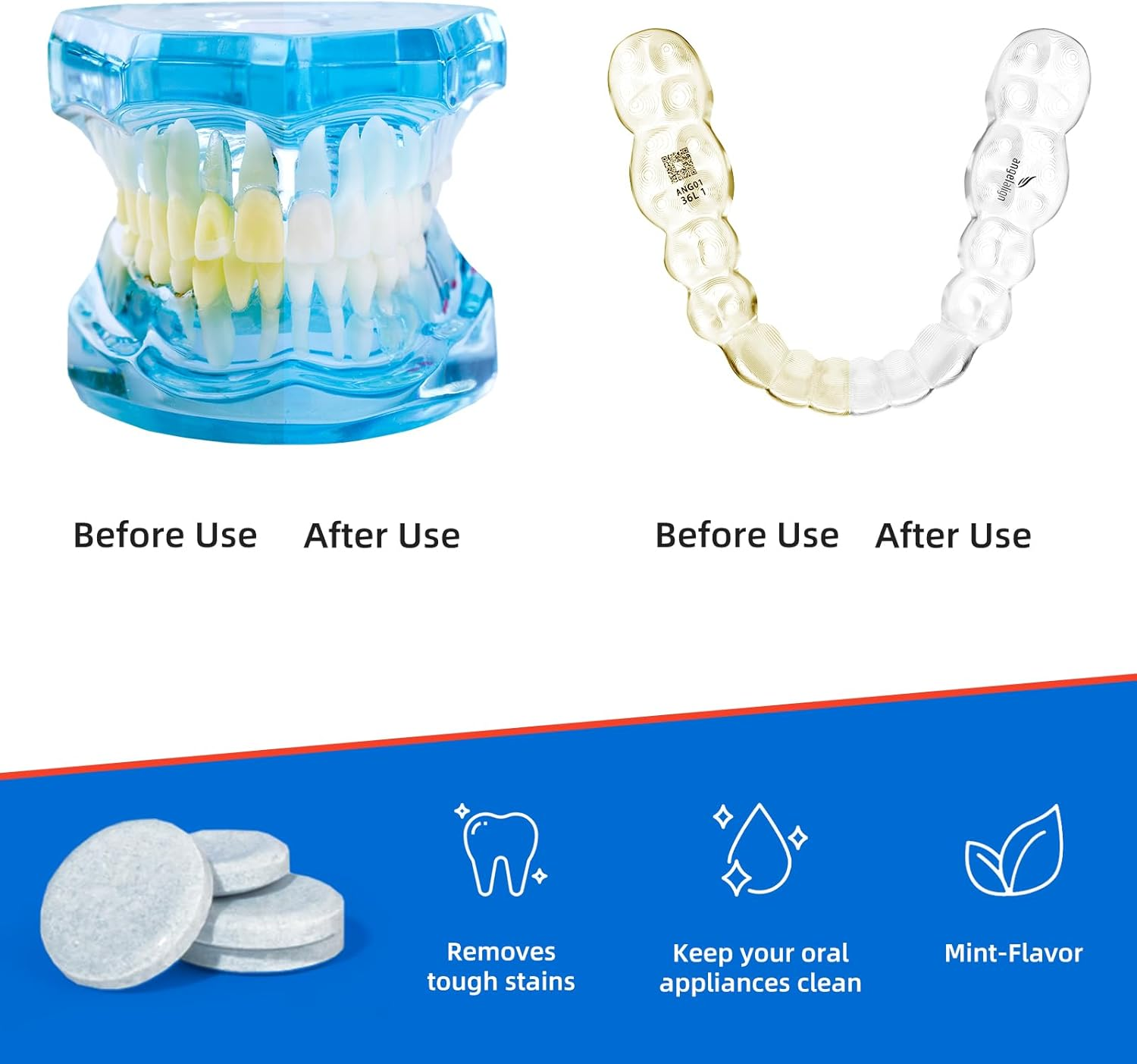 Y-Kelin Retainer Cleaner Tablets 120 Tablets for Mouth Guard Dental Appliances Denture Cleaning Tablets 4 Months Supply image number 1