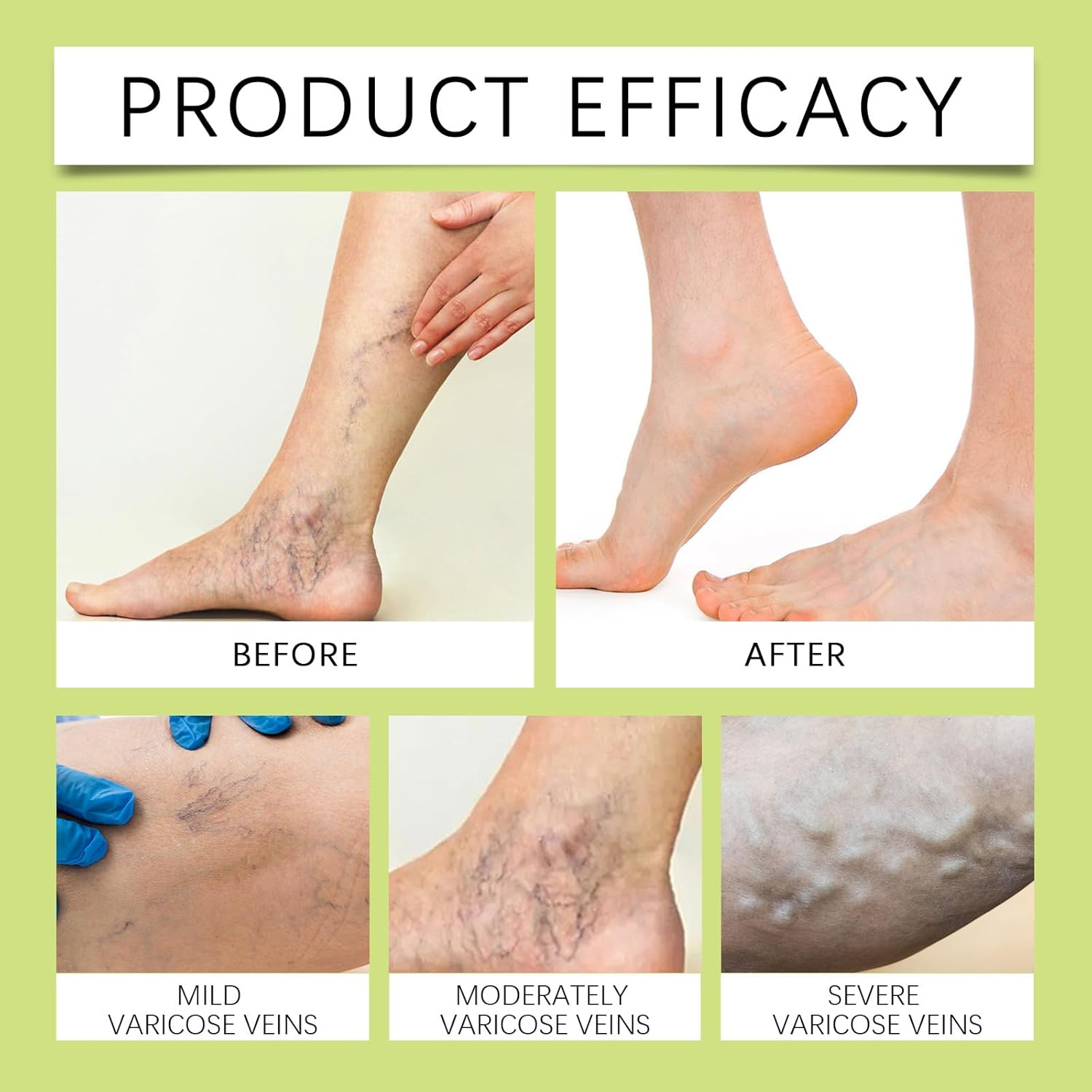 Miracle Balm, Natural Ingredients Soothing Cream for Legs Arms & Back Long Lasting Comfort, Skin Friendly Moisturizing Body Massage Balm for Men Women, Plant Extracts Herbal Cream (6PCS) - 1Pcs image number 4