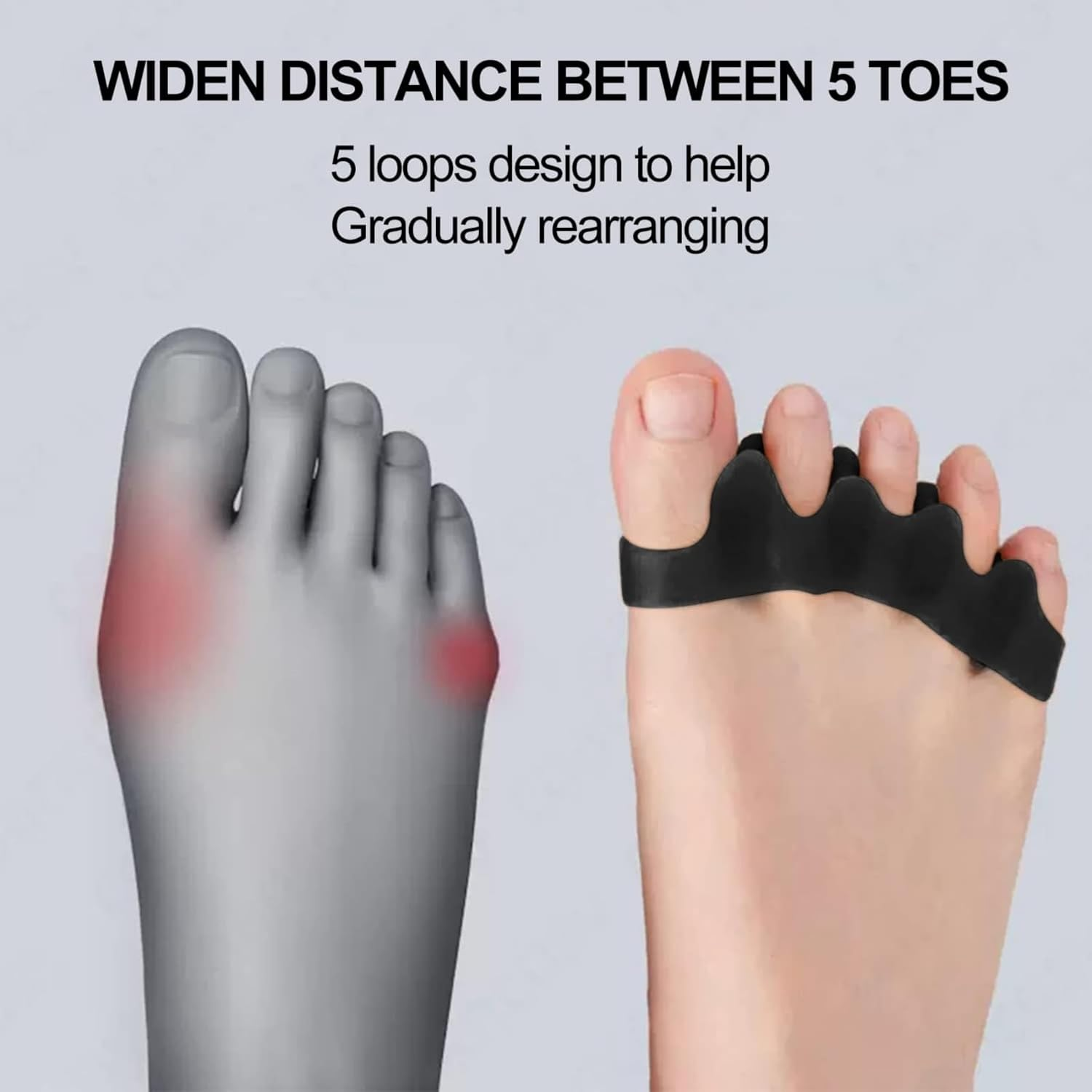 CHGEO Medical Grade Silicone Toe Separators & Spacers for Women and Men &ndash; Doctor Recommended Bunion Corrector, Hammer Toe Straightener, Plantar Fasciitis Relief &ndash; Running & Pedicures image number 5
