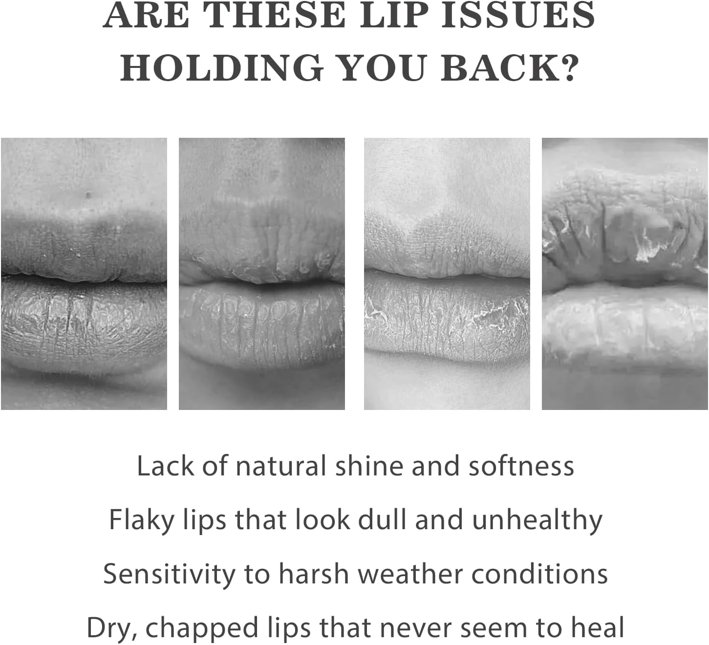 Tallow Lip Balm with Beeswax and Beef Tallow, Honey Flavour, Moisturizer Grass Fed Tallow Balm Care,5G*2