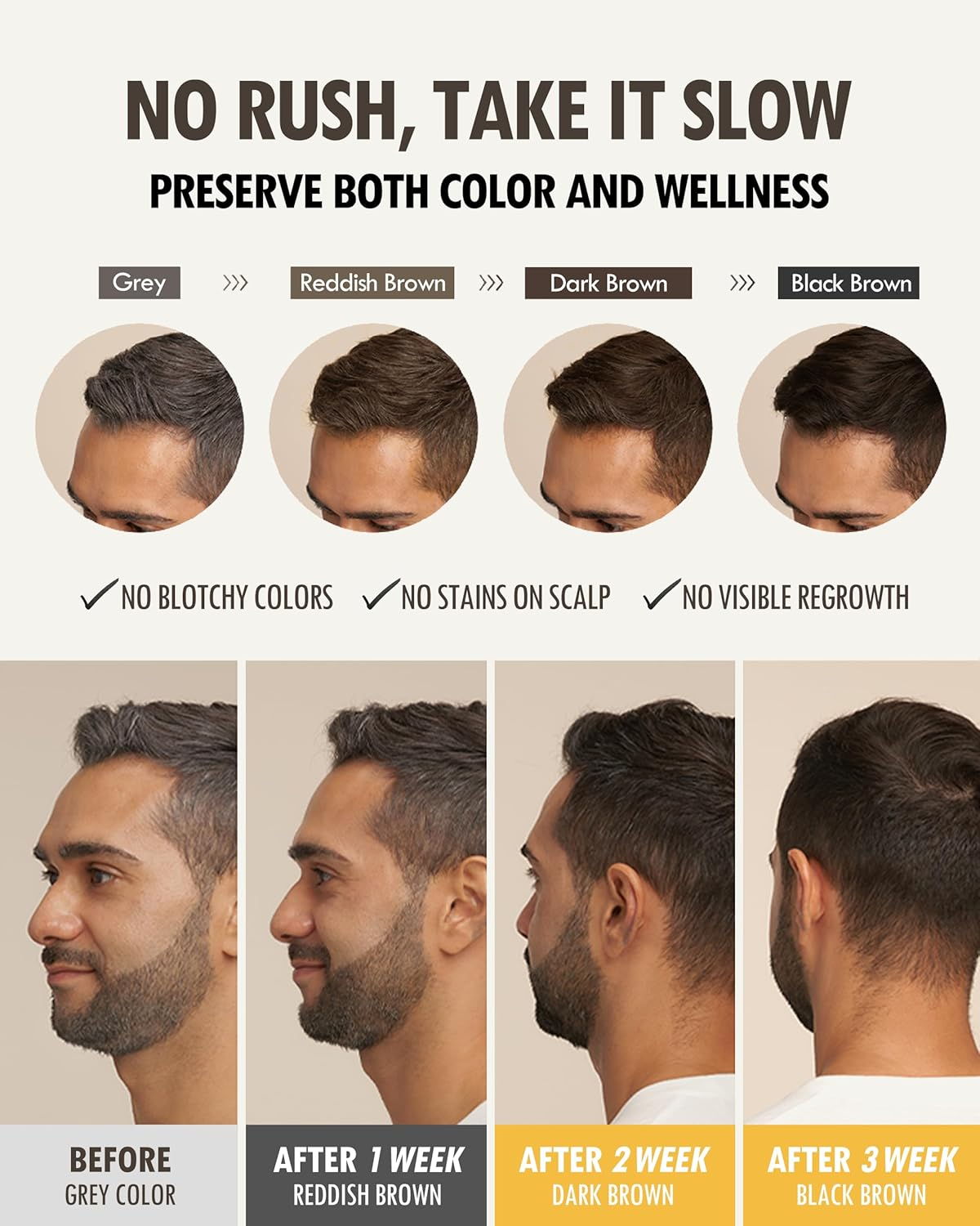 Moda Moda Zero Gray Black Hair Shampoo 300 G image number 6