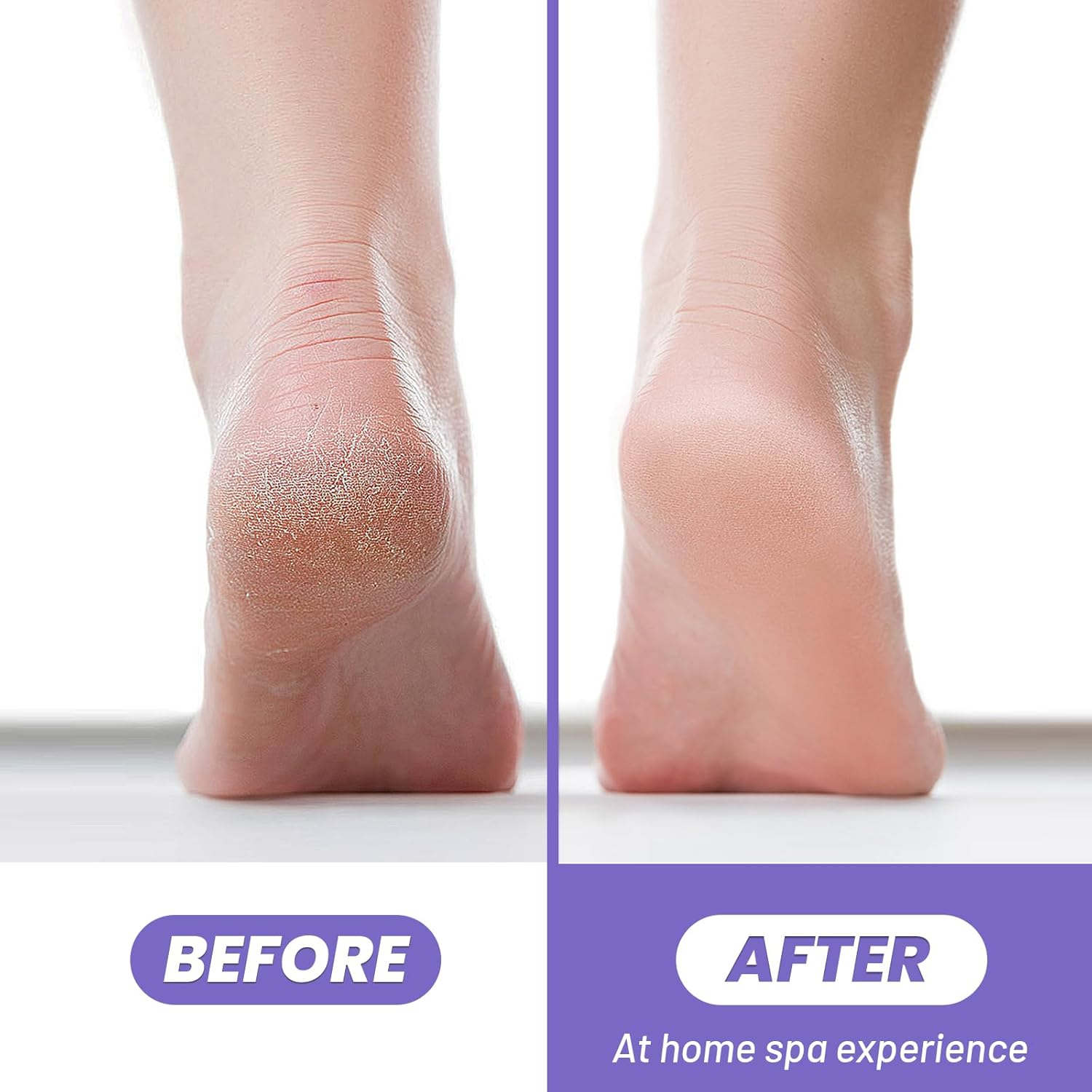 Foot Pumice Stone,Breenhill Feet Hard Skin Callus Remover and Scrubber for Dead Skins 2 Sided (Purple,4Pcs) image number 2