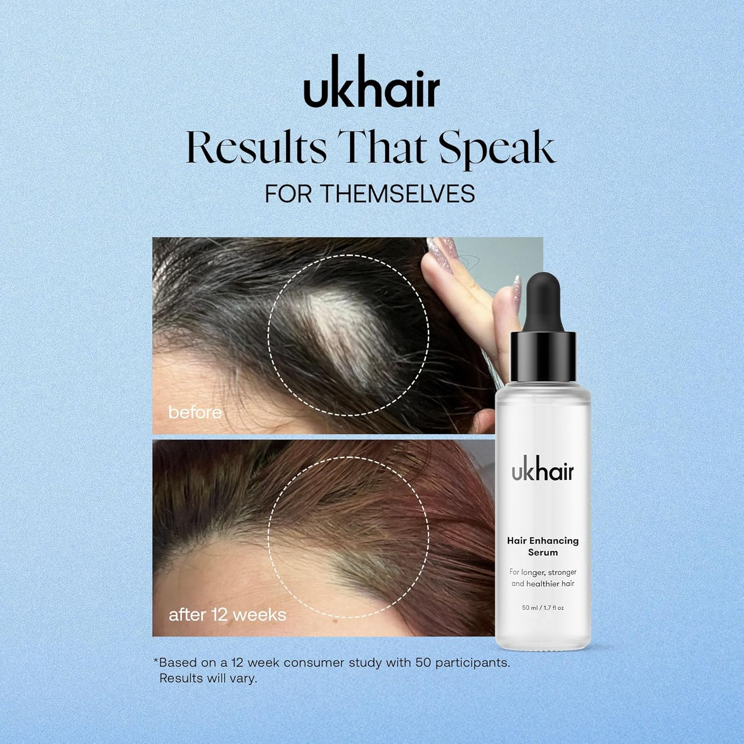 Uklash Ukhair Hair Growth Serum 50 Ml
